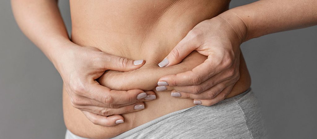 Tratamentos Estéticos para Gordura Localizada